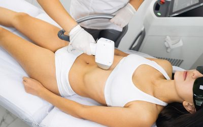 Discover the Benefits of Choosing Laser Hair Removal